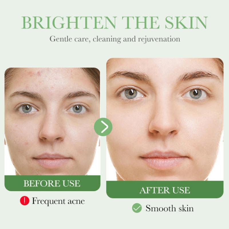 Bioaoua Centella Asiatica Lenitivo e Riparatore Set da Sei Pezzi Schiarente Rassodante Anti-Età Set Bellezza Viso Skincare