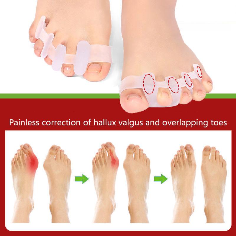 1Pair Toes Separator Suitable Bunion Corrector Material Soft Gel Straightener Spacers