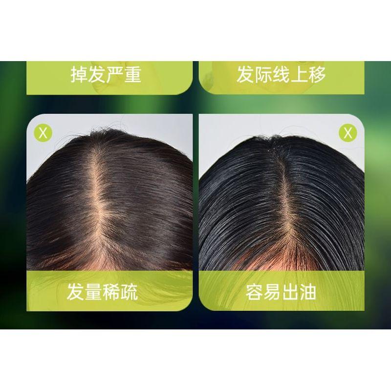ZOOLY - No.7 Ginger Scalp Nutrient Solution