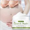 Stretch Marks-Smooths & Tones Scars-Reduces Dryness and Wrinkles-Safe To Use For Pregnant Women, 50g