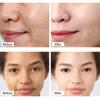 Dark Spot Removal Whitening Skin Cream Remove Melasma Acne Spot Pigment Melanin Dark Spot Pigmentation Moisturizing Gel