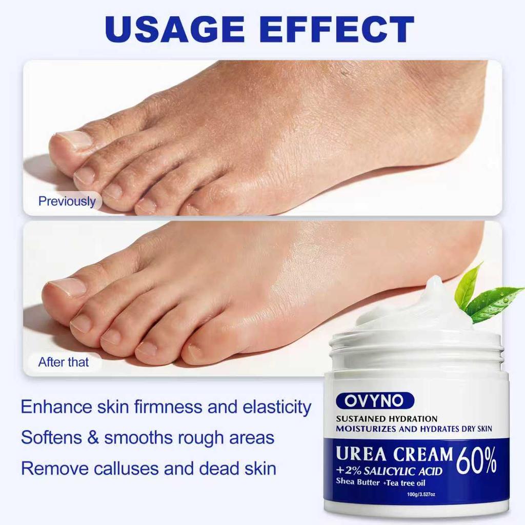 Cremă cu Uree 60%, 100G, Pentru Picioare și Mâini Aspre, Bogată în Ulei de Jojoba, Ulei de Arbore de Ceai, Ajută la Calmare și Alinarea Pielii, Iritație Scăzută, Hidratare Ridicată,