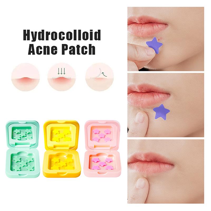 25/48 Patches Hydrocolloid Acne Patch Fade Repair Invisible Acne Removal Stickers Concealer Makeup Tool Star With Mirror