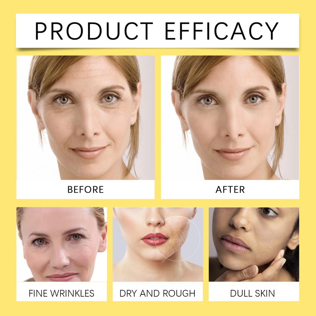 OUHOE Schnecke 92 Gesichtscreme Feuchtigkeitsspendend Feuchtigkeitsspendend Reparatur Anti-Aging Faltenpflege Nährend Glatte Haut Alles in Einem Hautpflege