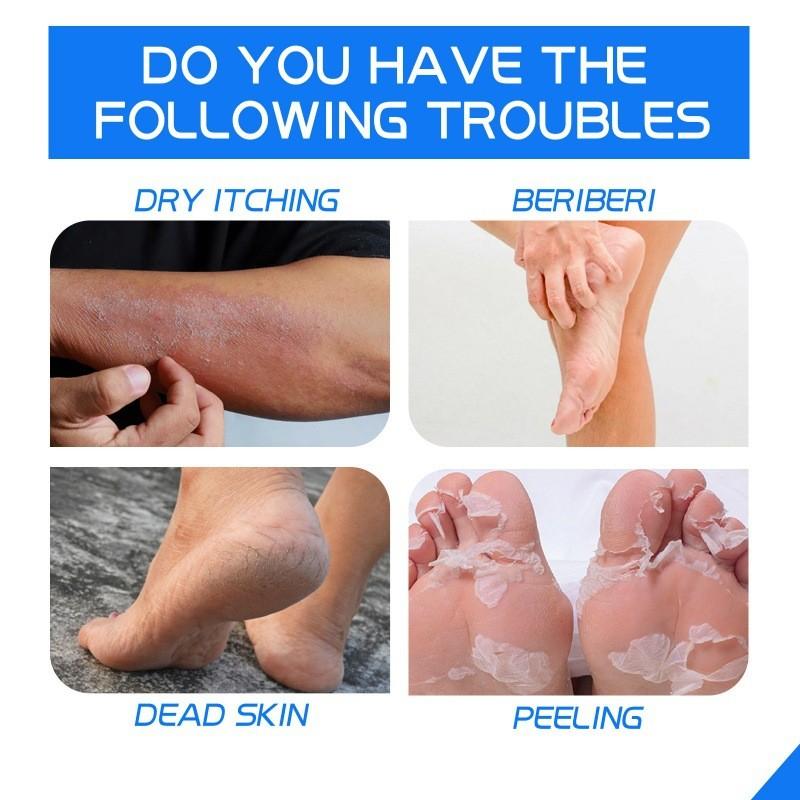 Ximonth Heel Repair Cream For Cracked Dry Skin Nourishing Moisturizing Foot Care 40g