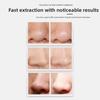 Non Damaging Pores Blackhead Remover Adjustable Power Beauty Device  Personal Care