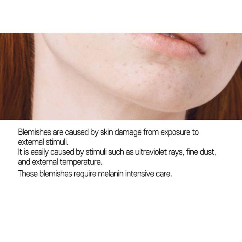 ΦΡΟΝΤΙΔΑ:NEL - Αντι-Μελάσμα Κρέμα Cica