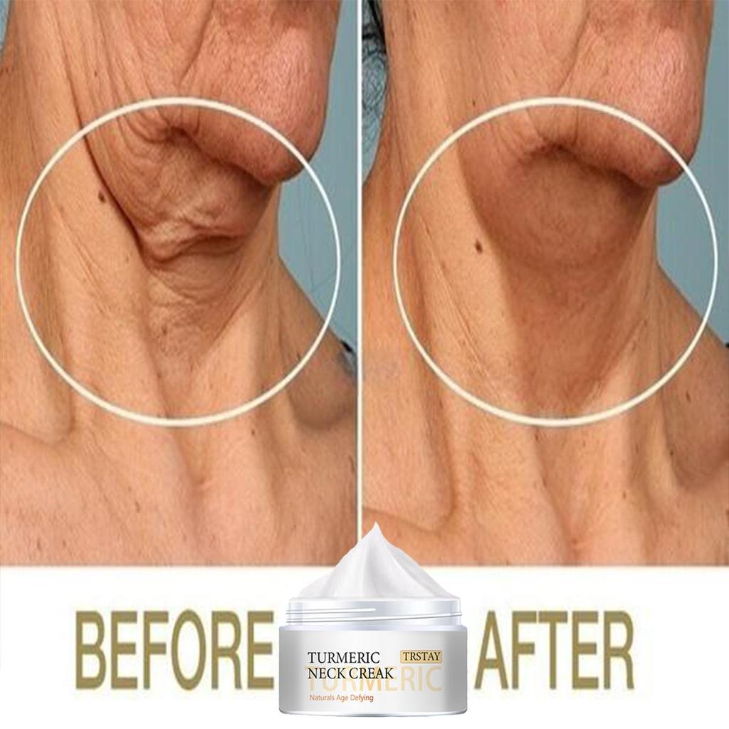 Crema antirughe Rassodante Lifting Viso Collo Anti-età Rimuovere le linee sottili Notte Giorno Idratante Sbiancamento Cura della pelle