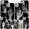 Autumu X Ray Hand Bones Phnoe Case for Iphone 17 Air 16 16E 11 12 13 Mini 14 Plus 15 Pro Max 7 8 + SE 2020 Phone Cover Coque