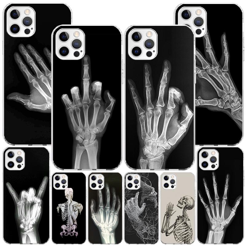 Autumu X Ray Hand Bones Phnoe Case for Iphone 17 Air 16 16E 11 12 13 Mini 14 Plus 15 Pro Max 7 8 + SE 2020 Phone Cover Coque