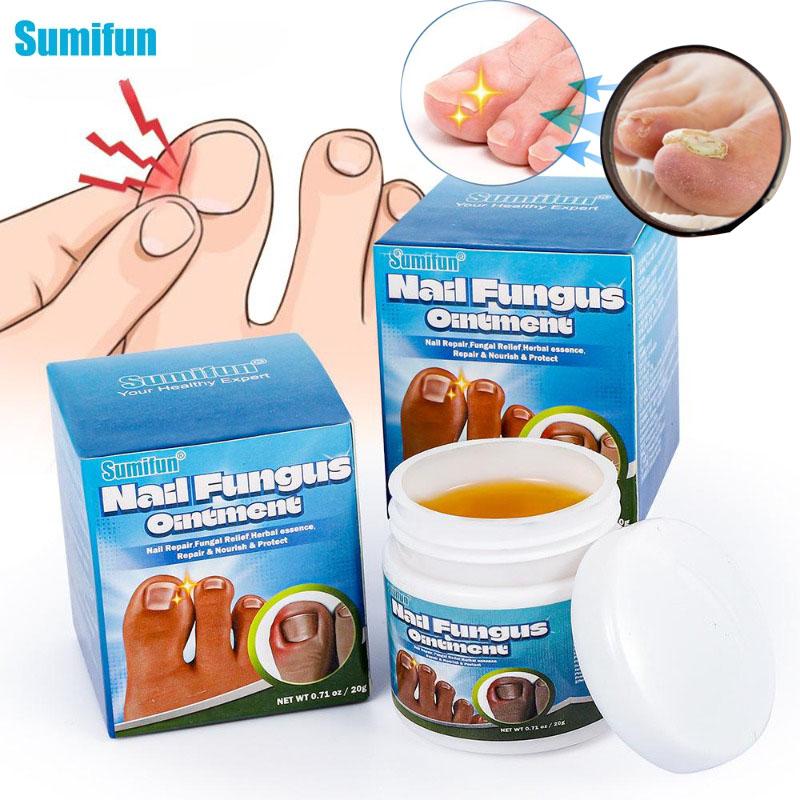 1/2pcs Jiagoukang Cream Thick Toenail Care Cream