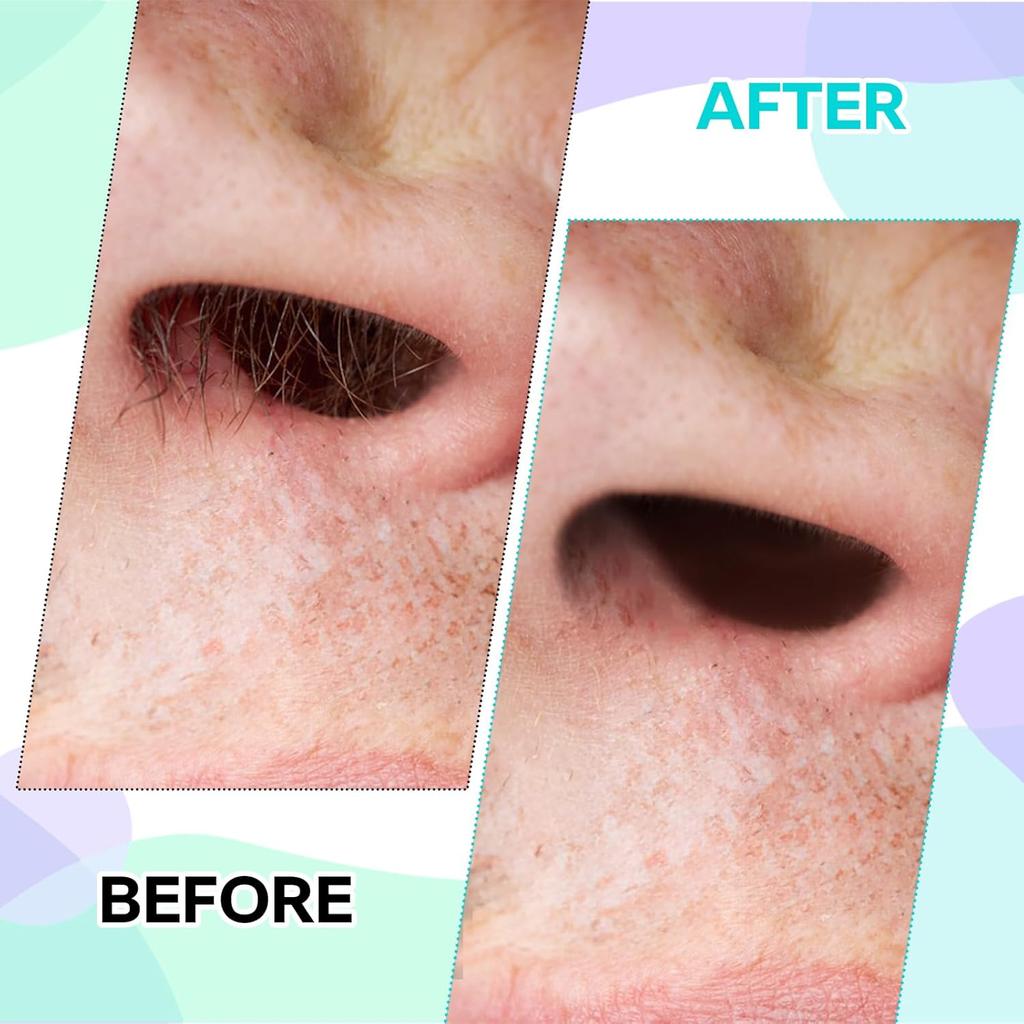 Nose Wax Hair Removal Kit - 10/20/100 Pcs Beeswax Sticks for Nose, Beard & Eyebrow | Safe, Fast & Painless Hair Remover Tool