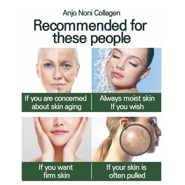 ANJO Noni Collagen Firming Cream 100ml (3 Options)