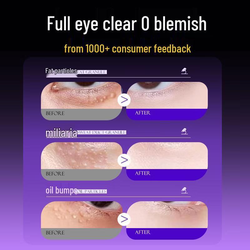 Layanana Eye Cream for Milia, Dark Circles & Fine Lines