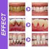 EELHOE V34 Purple Toothpaste Repair Teeth Oral Cleaning Breath Fresh Dazzling White Toothpaste