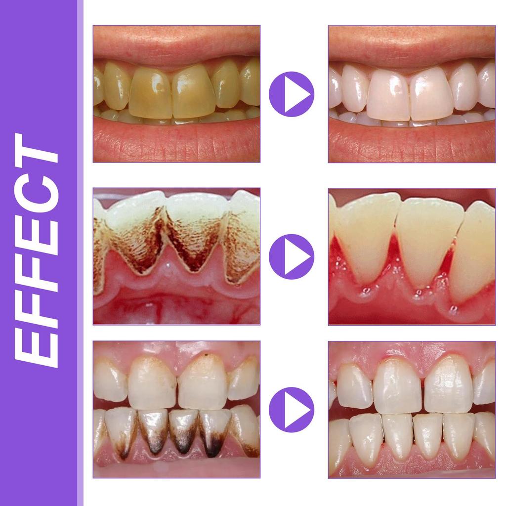 EELHOE V34 Purple Toothpaste Repair Teeth Oral Cleaning Breath Fresh Dazzling White Toothpaste