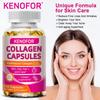 Hydrolysiertes Rinderkollagen Kapseln mit Biotin & Vitamin C, GVO-freies Nahrungsergänzungsmittel, 120 Kapseln 60-Tage-Vorrat