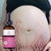 Těhotné ženy opravují břišní vrásky, poporodní opravný krém, preventivní tělový krém, hydratuje pokožku, odstraňuje těhotenské vrásky, tukové vrásky, krém na obličej