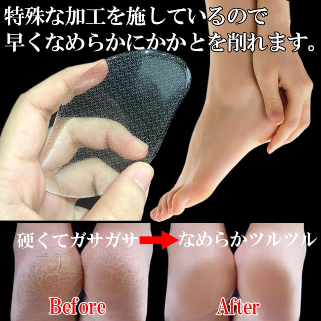 Calus Călcâi Călcâi Calus Călcâi Calus Lavabil Unghie Unghie Sticlă Set Îngrijire "Eooplus" Remover, Pilă, Îndepărtare, Îngrijire, Remover, Pilă, Lustruitor,