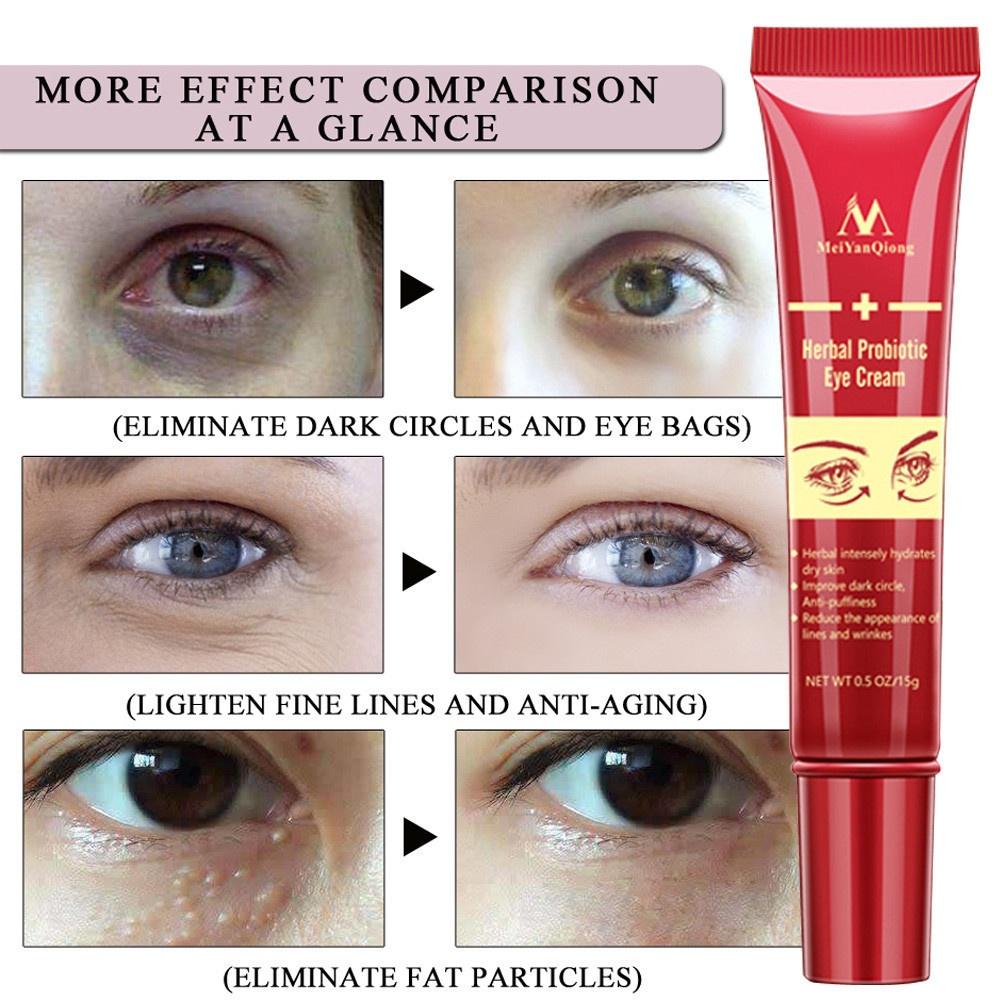 2 Boxes Eye Cream Gel For Dark Circles Puffiness Wrinkles Bags Most Effective Anti-Aging Eye Cream