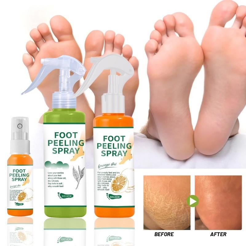 Eelhoe Exfoliating Care Spray With Green Tea And Citrus Scent For Soft Feet And Elbows