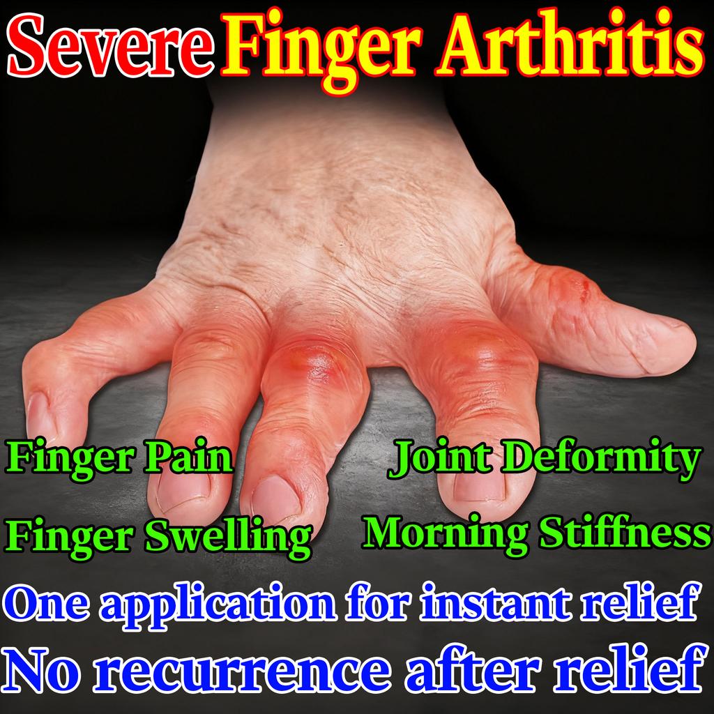 Kräuterformel-Creme - Lindert Gelenkschwellung Deformität Sanft zu empfindlicher Haut