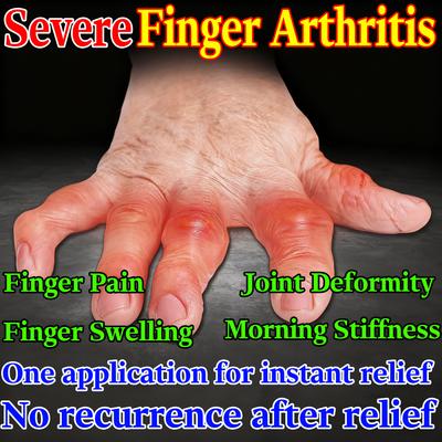 Herbal Formula Cream - Eases Joint Swelling Deformity Gentle On Sensitive Skin