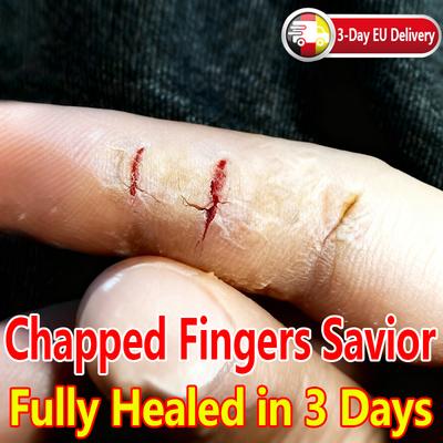 Lehký gelový krém na popraskané ruce a nohy - Bylinný hydratační a regenerační