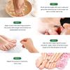 Sumifun Nail Care Ointment With Soothing Formula For Foot And Hand Maintenance