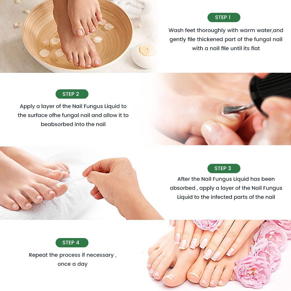 Sumifun Nail Care Ointment With Soothing Formula For Foot And Hand Maintenance