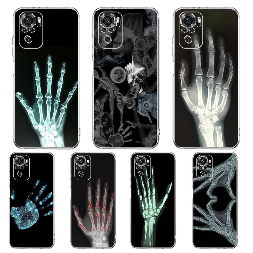 Transparent Phone Case for Redmi 14C 13C 10C 10 9 Note 13 12 11 K50 K40 Plus Pro 4G 5G Soft TPU Cover Autumu X Ray Hand Bones