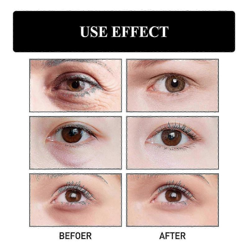 1pc Ouhoe Snake Venom Peptide Moisturizing Eye Cream Moisturizing, Lightening Fine Lines, Anti-aging And Anti-wrinkle | | 1PC