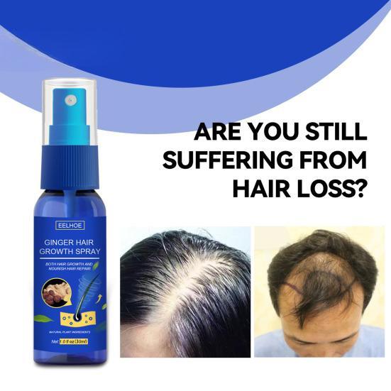 30ML Ginger Hair Growth Spray Oil for Hair Care Hair Growth Products Hair Loss