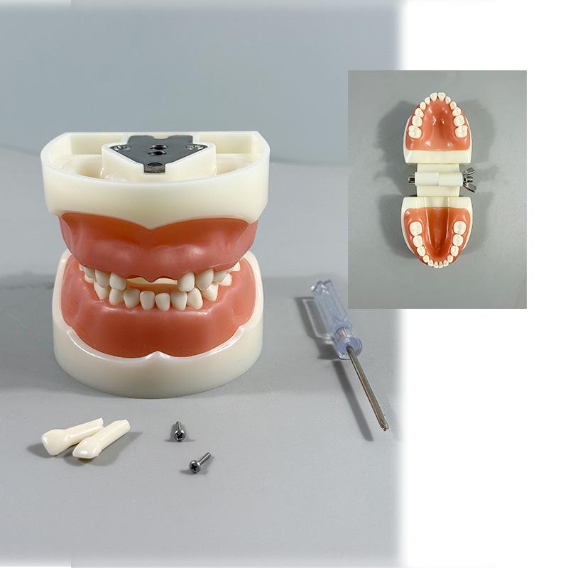 Прозора Знімна Повна Модель Щелепи з М'якими Яснами та Зубами для Підготовки до Імплантації