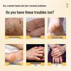 Moisturizing Hand and Foot Frostbite & Chilblains Cream for Dry, Cracked Skin with Fragrant Repair