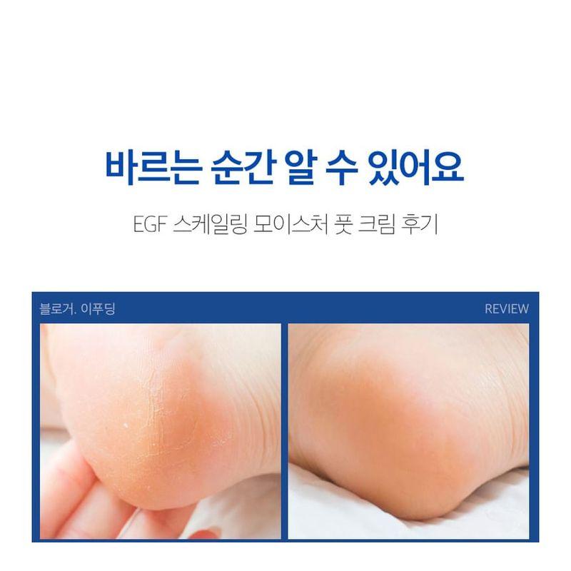 MEDIPEEL - EGF Scaling Moisture Foot Cream