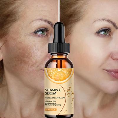 5G/15G/30G/50G/TRSTAY Vitamine C pour crème pour le visage Pigments Élimination des taches brunes Crème blanchissante pour le visage Produits de soins de la peau éclaircissants Beauté Santé
