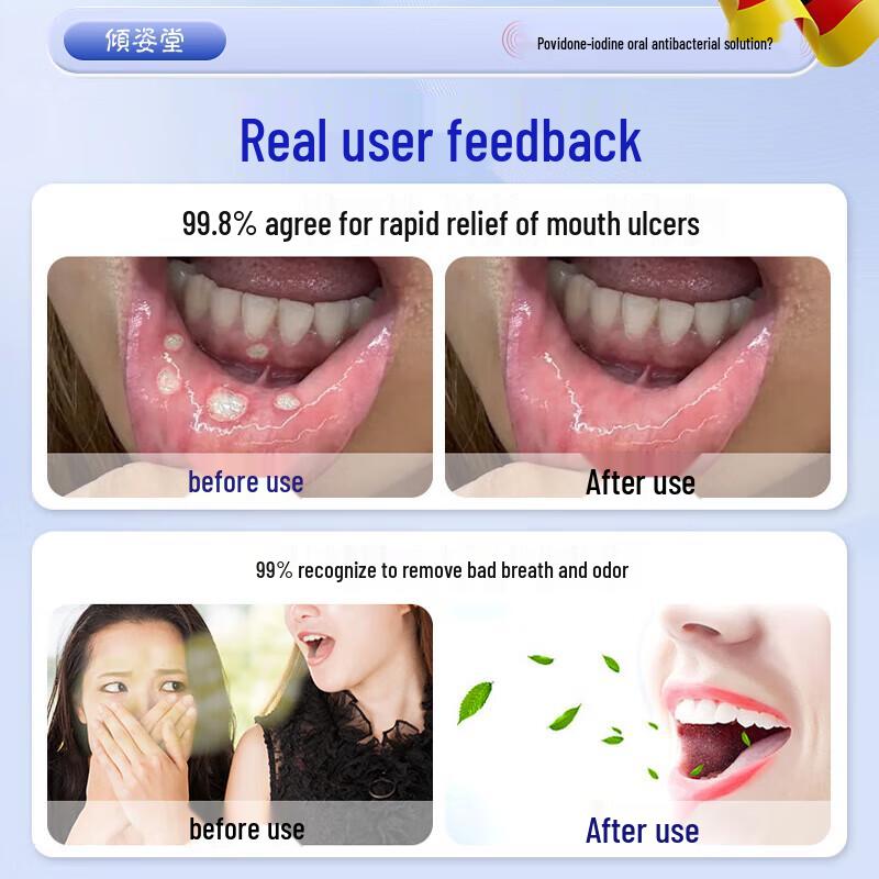 Qingzitang Povidone-Iodine Mouthwash