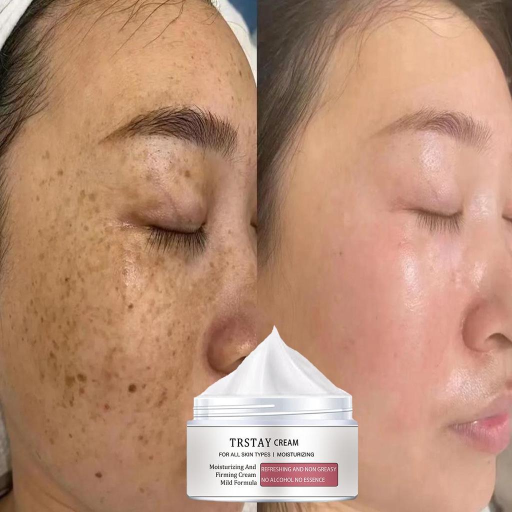 Sun spots chloasma arbutin anti-aging brightening skin whitening cream crema para manchas de la cara anti aging face cream