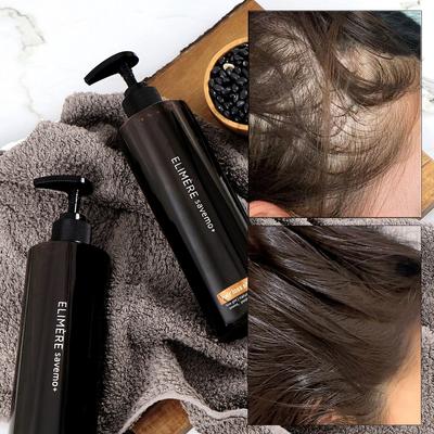 Savemo Hair Loss Shampoo Oily Shampoo Seborrheic Dermatitis 500ml, 2 Units