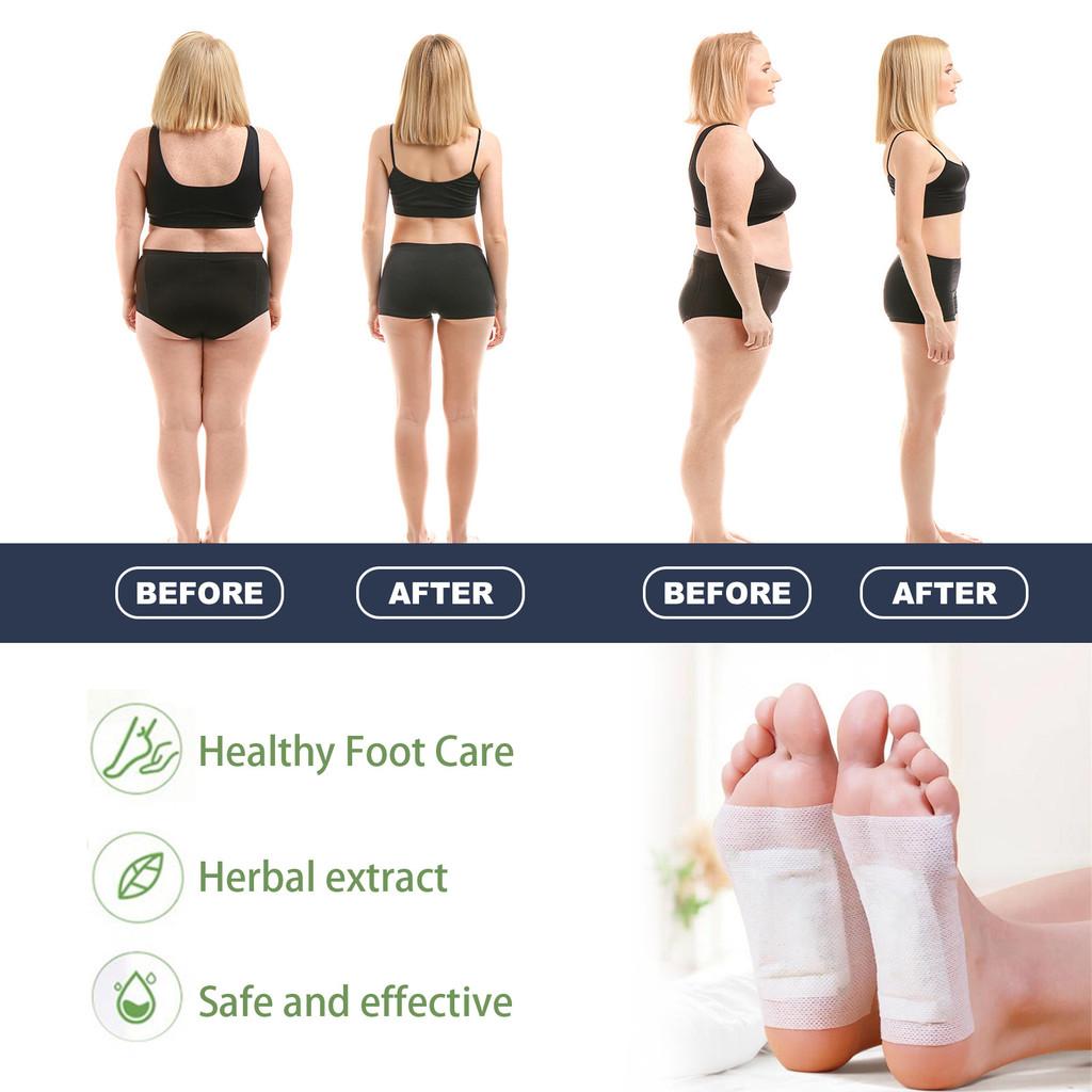 Ouhoe Ginger Foot Patches For Ultimate Foot Care And Slimming Tightening Effect
