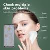 Skin Analyzer Dermatoscope Scalp/Skin/Hair Follicle Scanner Detector Testing Analysis Microscope 1 Million Ultra-clear Blue-ray