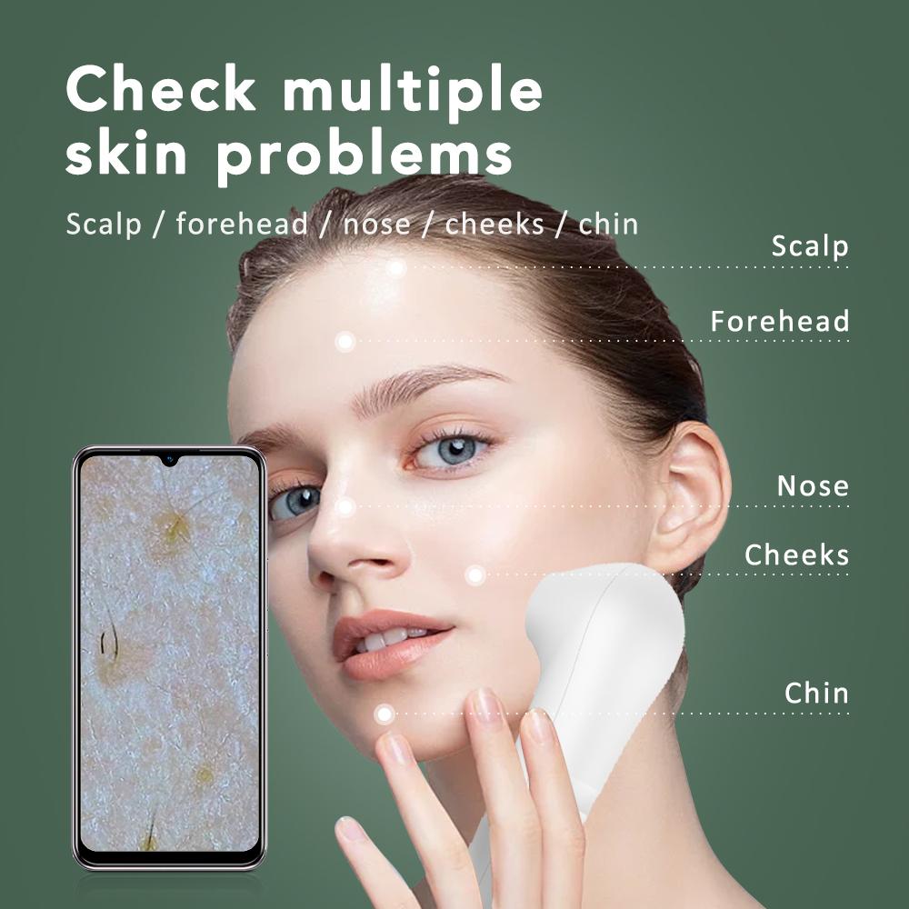 Skin Analyzer Dermatoscope Scalp/Skin/Hair Follicle Scanner Detector Testing Analysis Microscope 1 Million Ultra-clear Blue-ray