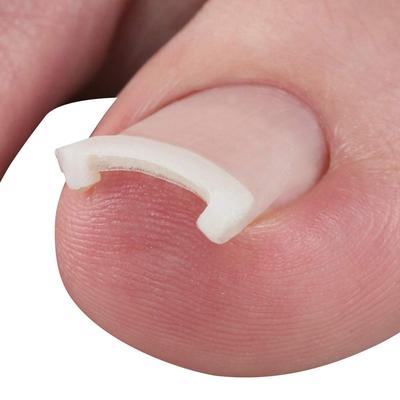 Plus Walk Equipo médico general Sello de corrección de uñas encarnadas Gancho de resina elástica Sello transparente fino Cyplus