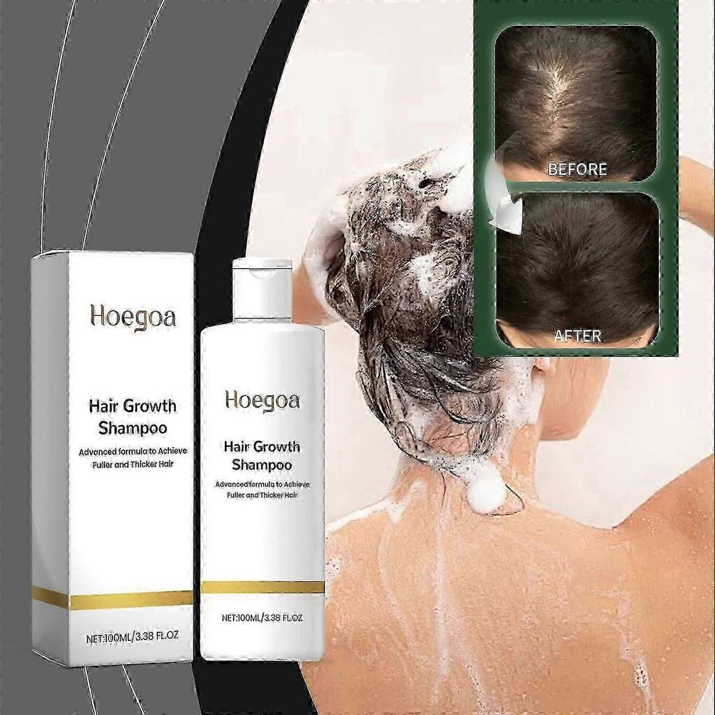 Hoegoa Rice Shampoo for Scalp Cleaning, Nourishing Hair, Repairing Hair Follicles, Smooth Hair Hair Shampoo