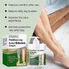 Crème Soulagement Jambes Œdème, Anti-Gonflement, Réduit l'Œdème & les Gonflements, Crème Thérapie Jambes, 1 pièce,sanbHR
