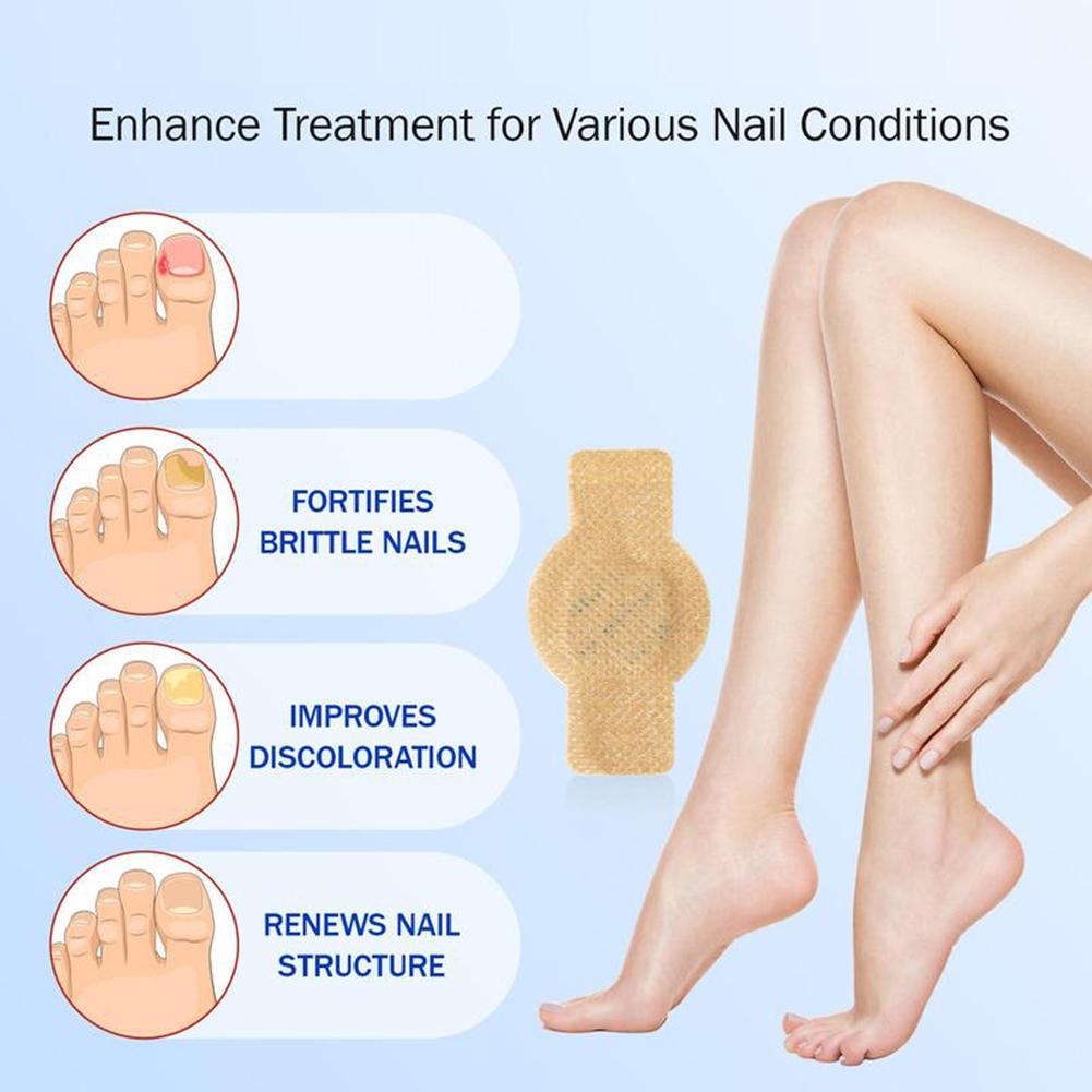 Fungal-Nail Patch Non-Irritation Strengthens Moisturizes Anti Toenail-Fungus Treat Sticker Quick Absorption Rehabilitation Patch