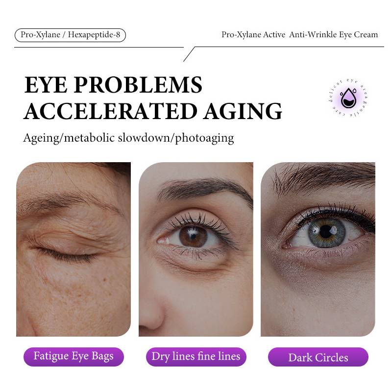 Activating Moisturizing Eye Cream 20g Reduce Fine Lines and Dark Circles Around Eyes