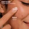 Oziva Spot Corrector for Acne with Green Tea Extract and Willow Bark, 20g