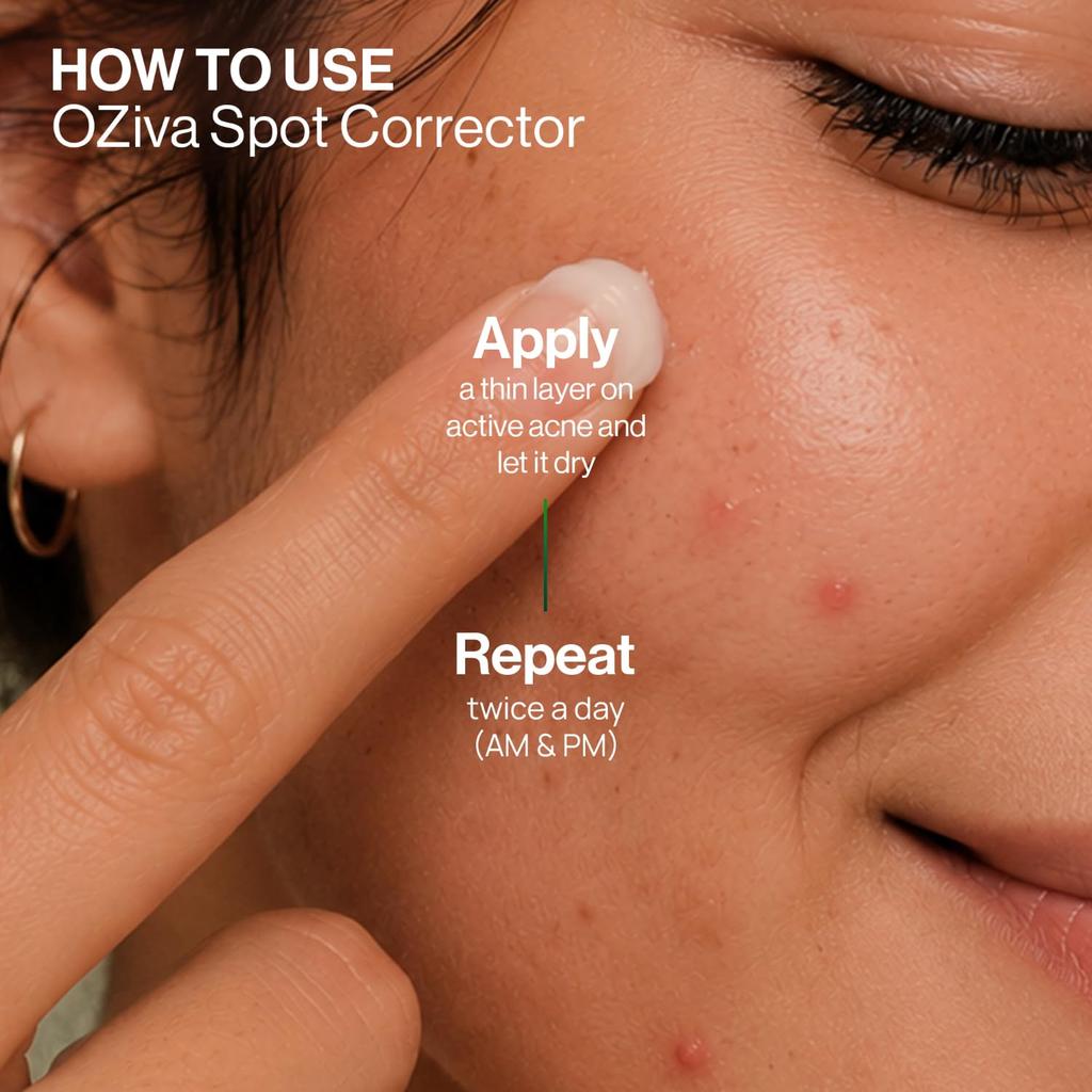 Oziva Spot Corrector for Acne with Green Tea Extract and Willow Bark, 20g